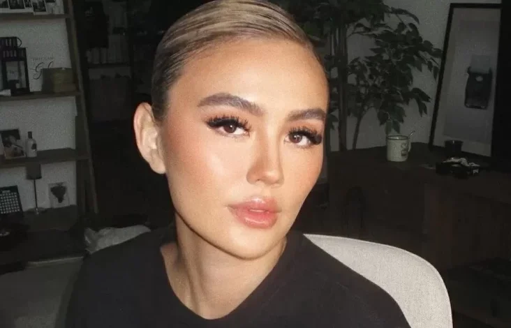 Mengenal Alopecia Areata, Penyakit yang yang disebutkan Menjangkit Agnez Mo hingga Alami Kebotakan