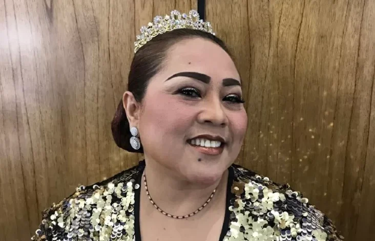 Nunung Stres Bolak-balik Solo-Jakarta untuk Berobat juga juga Bekerja hingga Idap Asam Lambung Kronis